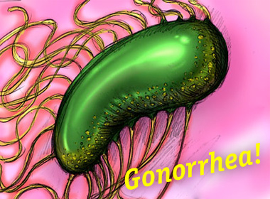 Look, it's Gonorrhea!